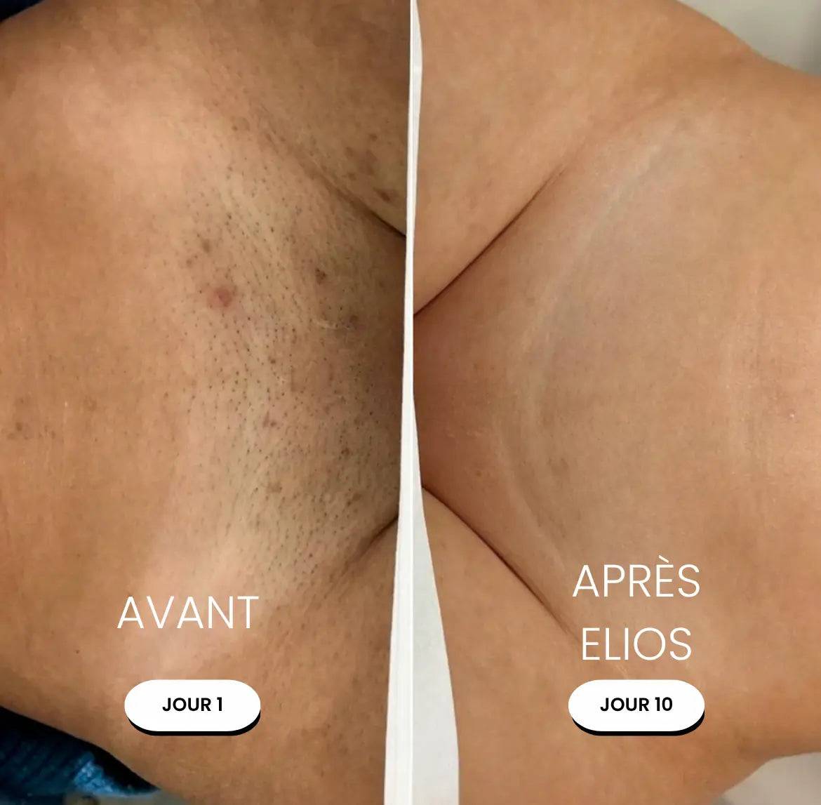 Rasoir 5-en-1 ELIOS ®