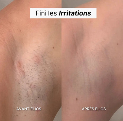 Rasoir 5-en-1 ELIOS ®